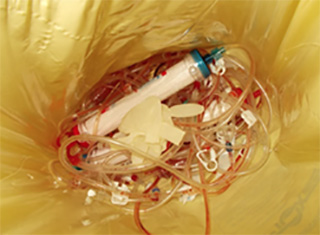 Treatment of dialyzers with the Integrated Sterilizer and Shredder